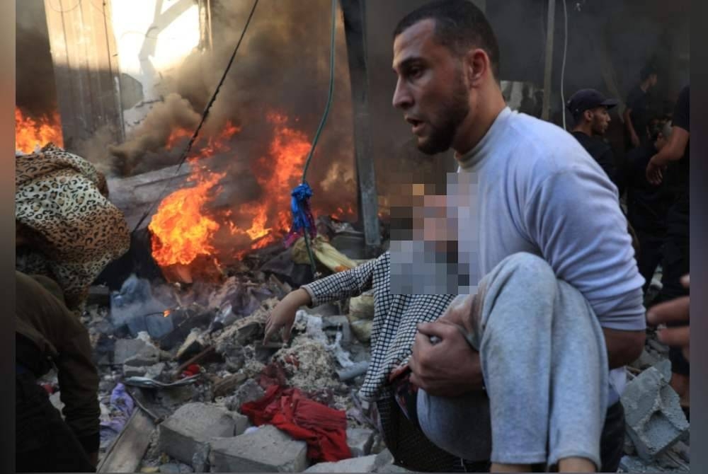 Kanak-kanak turut menjadi mangsa kekejaman Israel. Foto AFP