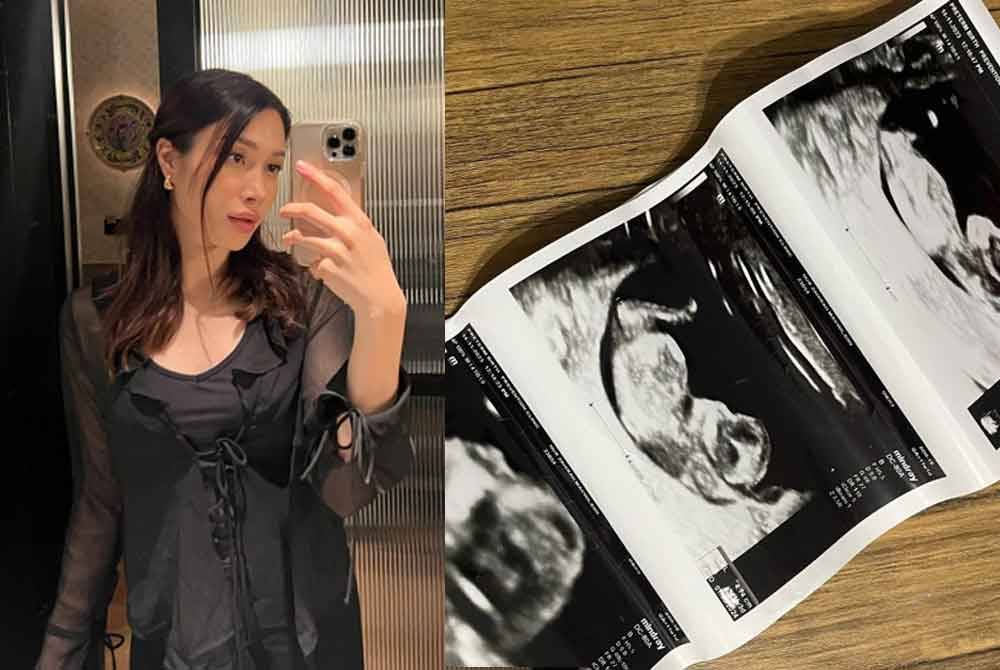 Zahirah berkongsi perkhabaran gembira di Instagram bahawa dirinya sedang hamil anak kedua.