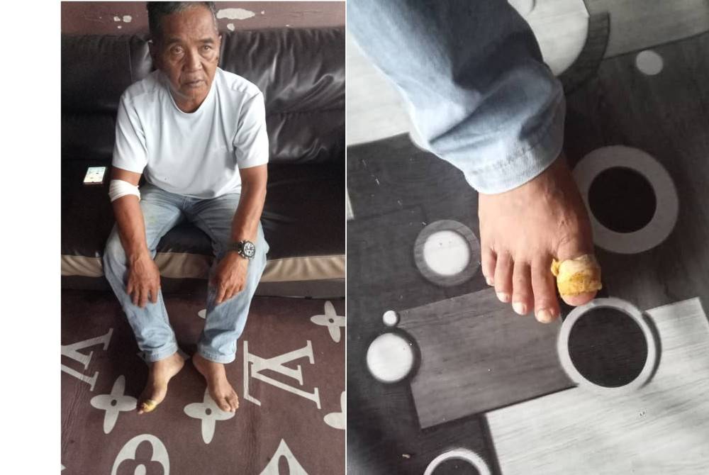 Saari alami kecederaan akibat dikejar anjing liar di Taman Desa Puteri, Bahau pada Selasa. Gambar kanan: Keadaan ibu jari kaki Saari yang cedera akibat kejadian itu.