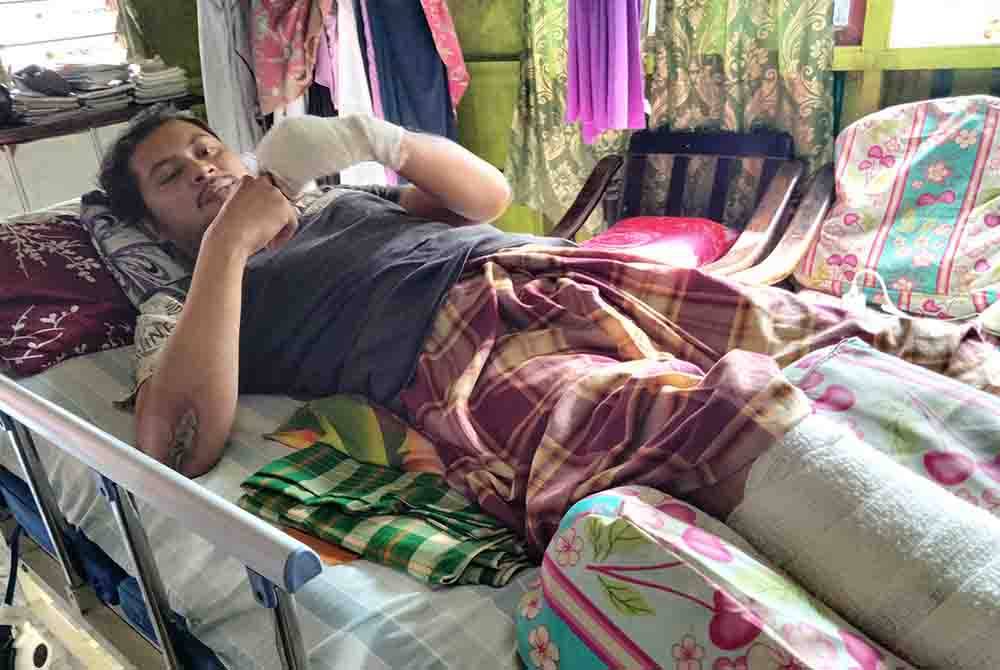 Omar menceritakan kejadian kemalangan yang mengakibatkan tangan kiri serta kaki kanannya patah.