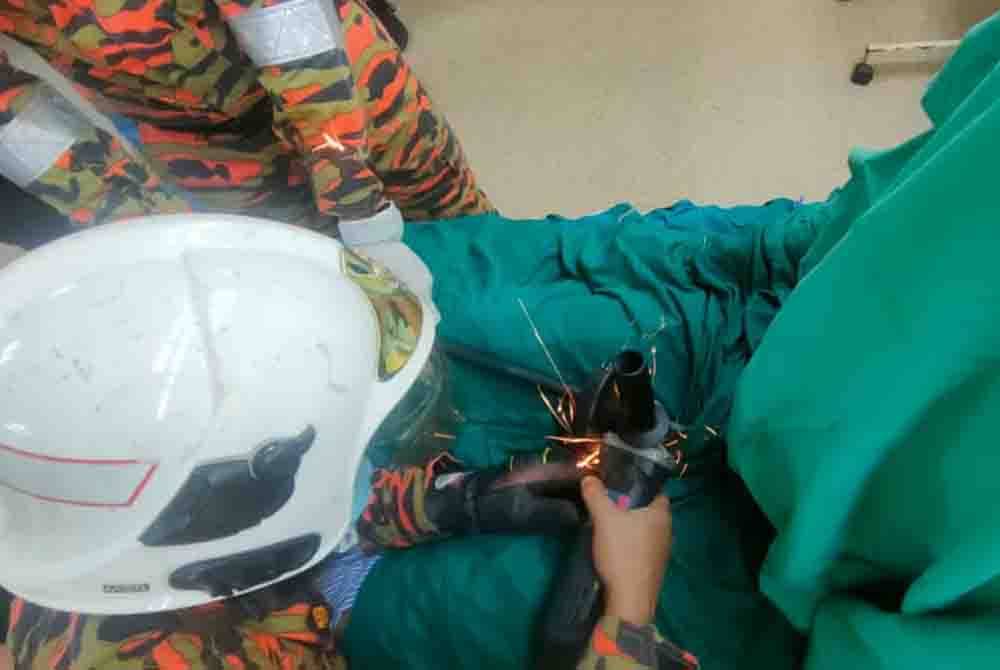 Bomba memotong besi yang tertusuk di perut mangsa dengan menggunakan mesin pemotong.