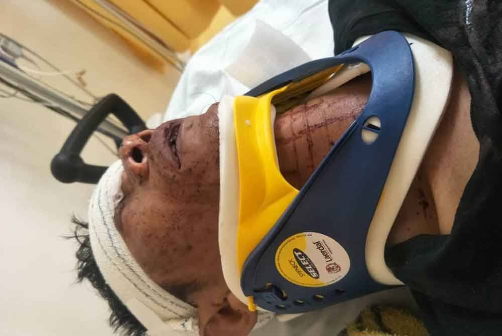 Keadaan Wan Edham Hawari ketika kemalangan pada Ogos 2022.