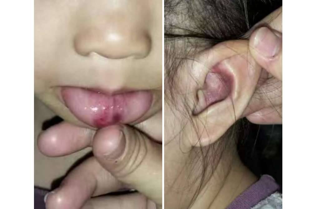 Mekanik ditahan polis selepas dipercayai mencederakan anak teman wanitanya dalam kejadian di dalam sebuah kenderaan di hadapan sebuah pasaraya di Bahau pada Rabu.