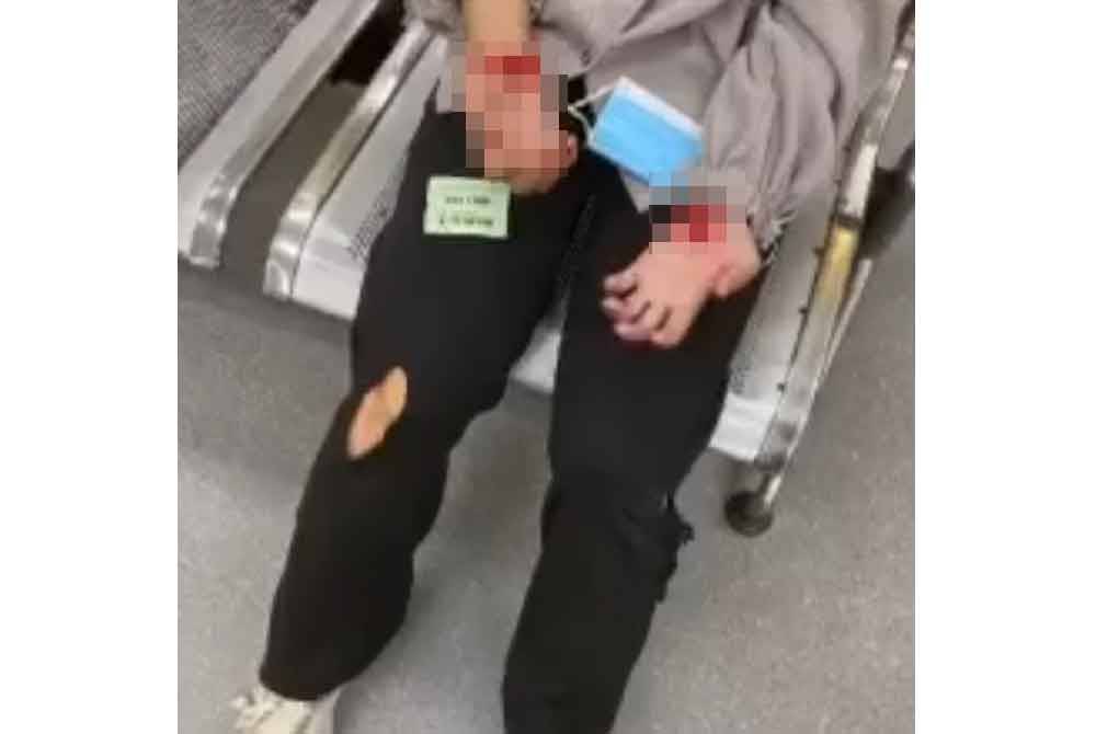 Kecederaan yang dialami mangsa selepas diragut dalam kejadian di Jalan Persiaran Raja Muda Musa, Klang, Isnin lalu.