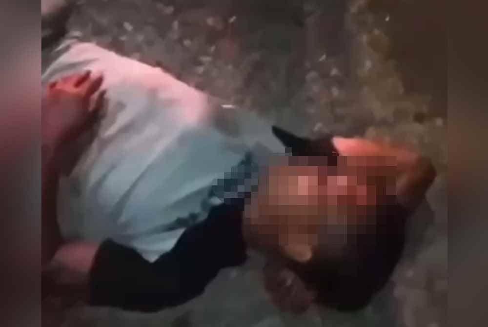 Suspek terbaring setelah kakinya digilis treler ketika cuba melarikan diri selepas menikam seorang pengawal keselamatan dalam kejadian awal pagi Sabtu. Foto media sosial