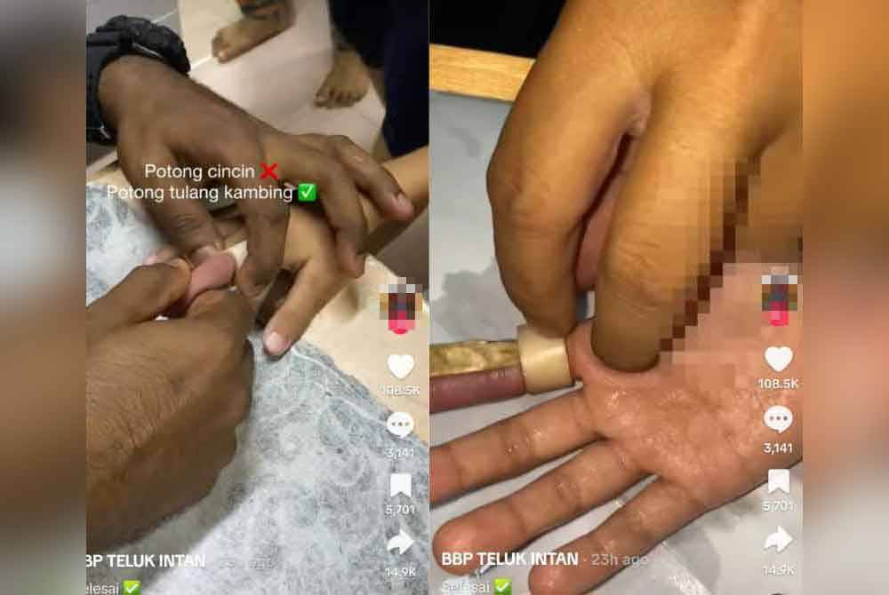 Tangkap layar video pasukan bomba menjalankan pemeriksaan sebelum memotong cincin tulang kambing, Rabu lalu. Foto pembaca