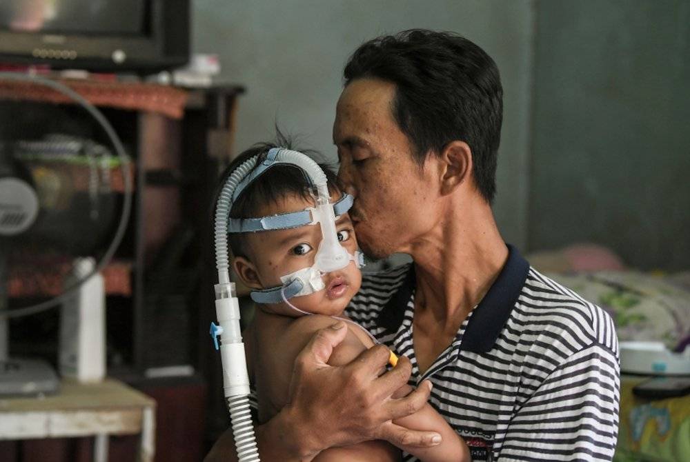 Mohd Azlan mencium anaknya, Mohd Aariz Zafran yang terpaksa bergantung pada alat bantuan pernafasan CPAP kerana menghidap penyakit paru-paru kronik. Foto Bernama