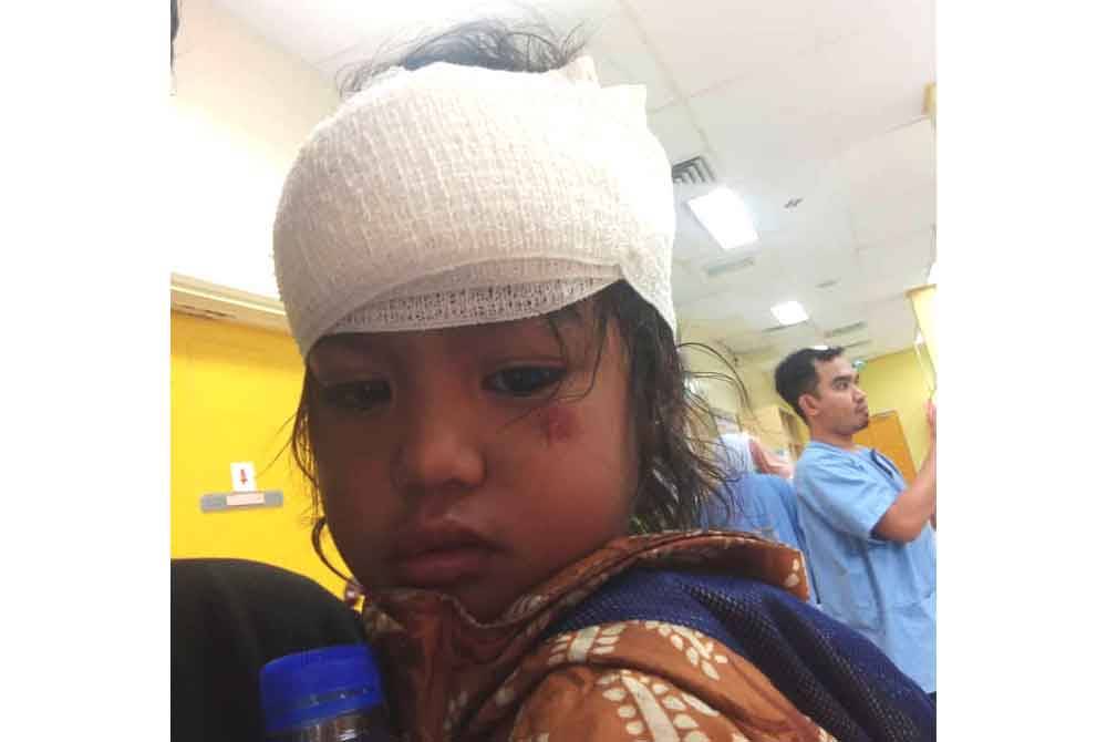 Anak Nur Nisa alami luka pada kepala dan muka akibat terjatuh daripada motosikal selepas dihempap dahan pokok patah. Foto ihsan Nur Nisa