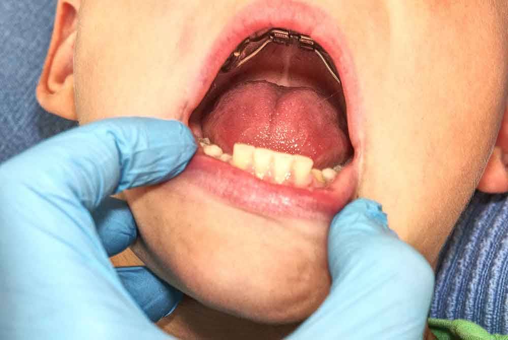 Gambar hiasan 123RF.