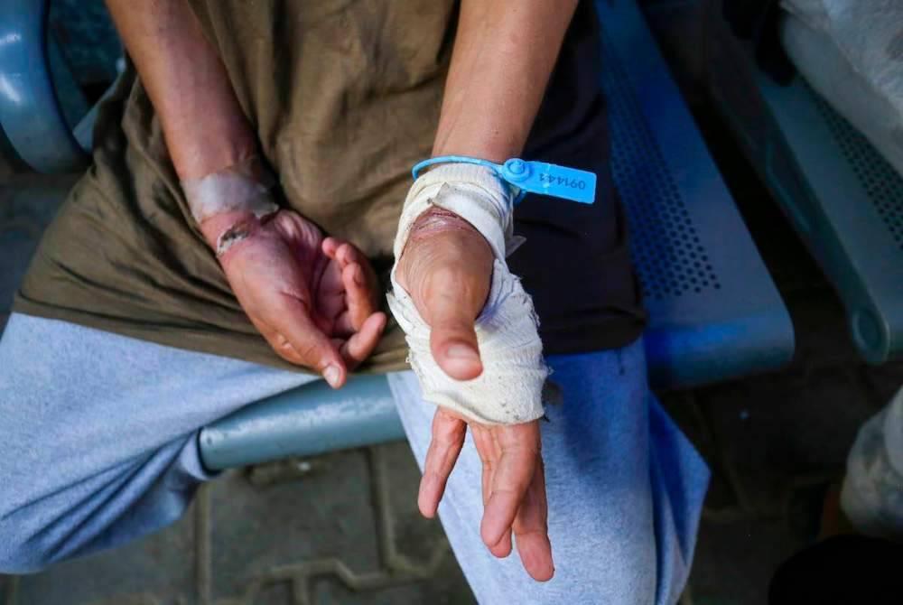 Antara kecederaan dialami bekas banduan akibat penderaan secara berterusan di penjara Israel.