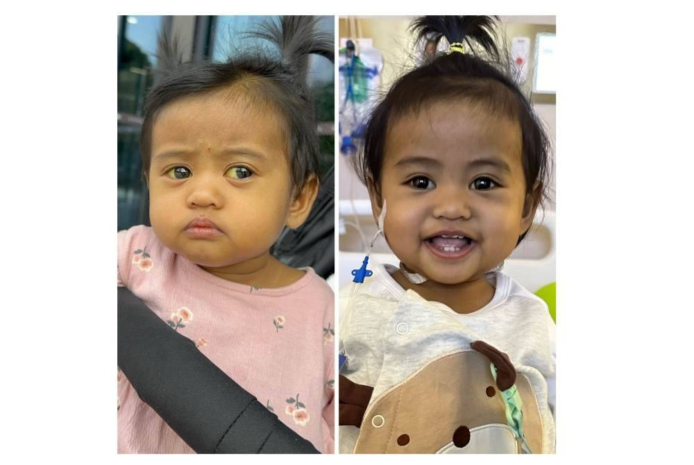 Perbezaan Ayra selepas menjalani pemindahan hati di Hospital Renji, China.