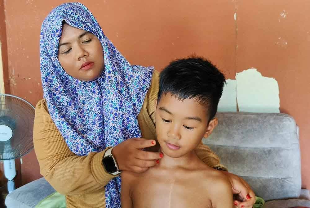 Nurliatul Hasni menunjukkan bibir Muhammad Ammar Solihin yang akan menjadi kebiruan setiap kali kepenatan akibat masalah jantung dihadapi.