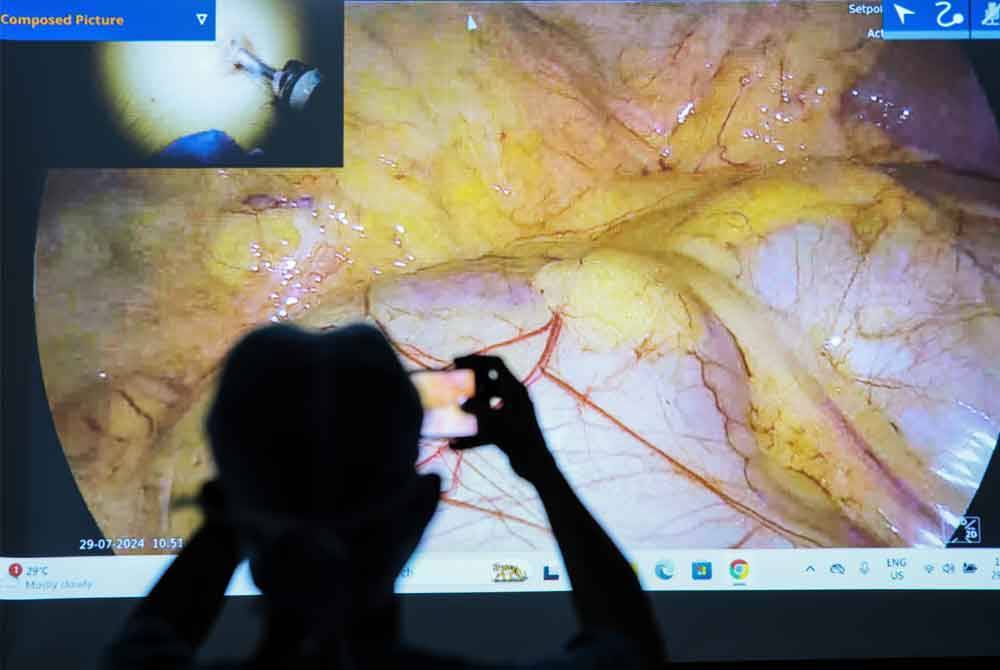 HoSZA menjadi hospital pertama di Pantai Timur yang menggunakan kaedah itu, mempunyai pelbagai kelebihan berbanding kaedah pembedahan konvensional termasuk mengurangkan tahap kesakitan pasca pembedahan, kos yang lebih efektif dan kadar penyembuhan lebih cepat. Foto Bernama