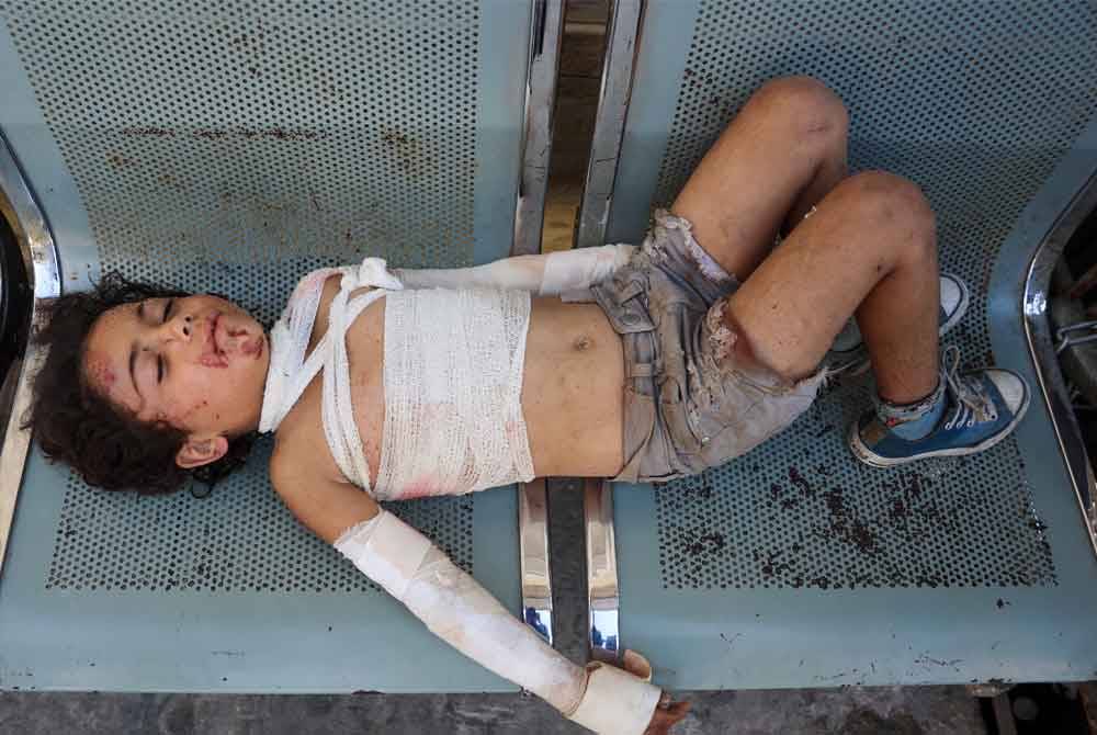 Kanak-kanak Palestin yang cedera dalam serangan di Bandar Gaza dirawat di sebuah hospital berhampiran.