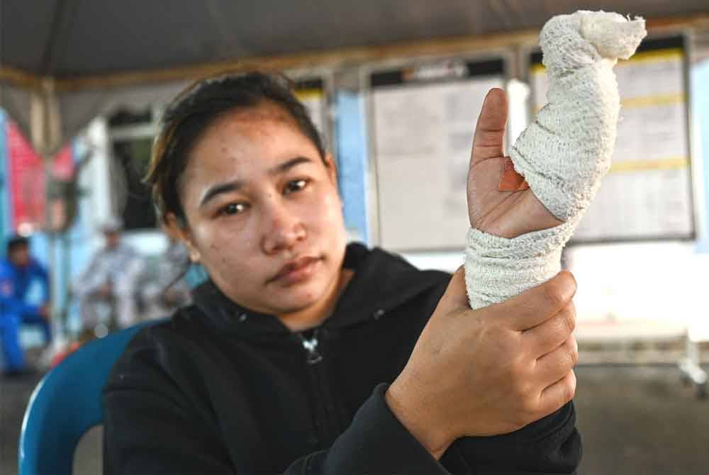 Ain Farhana menunjukkan tangan kirinya yang cedera ketika berusaha menyelamatkan diri selepas bot dinaiki terbalik dan karam di perairan Kemaman.