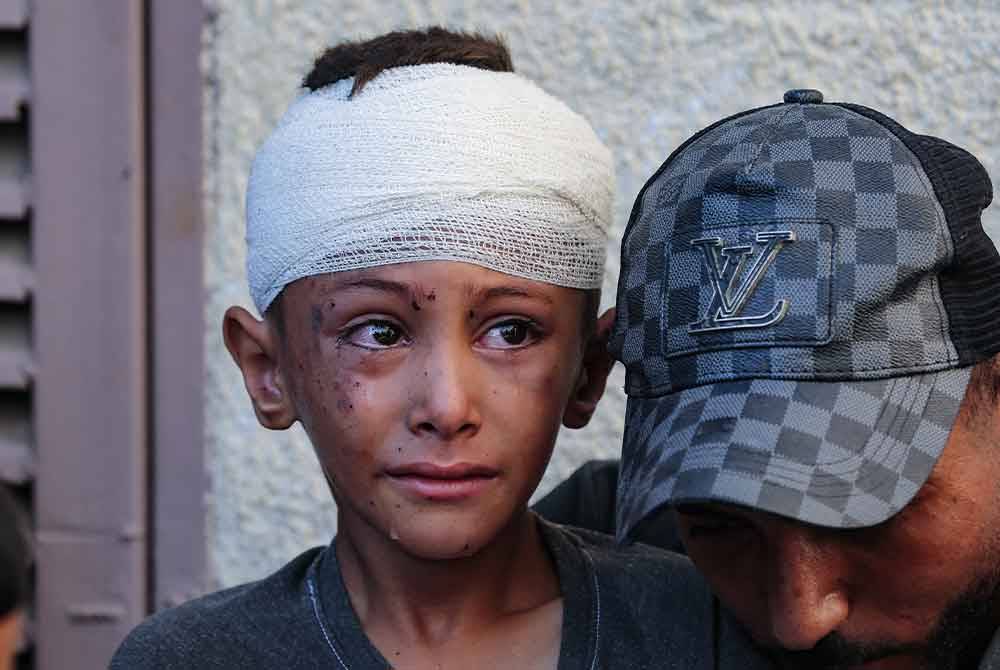 Seorang kanak-kanak menangis selepas mengalami kecederaan di kepala susulan serangan udara Israel di rumah mereka di Deir el-Balah. Foto AFP
