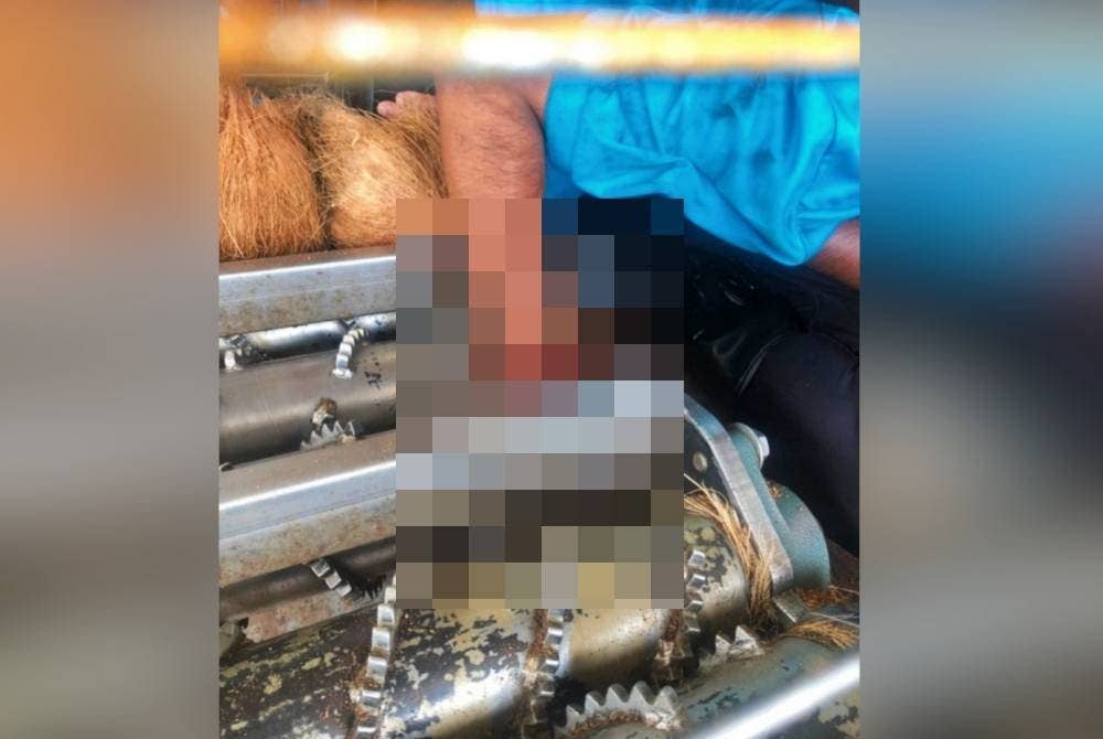 Keadaan tangan mangsa yang tersepit dalam mesin membuang sabut kelapa di sebuah kilang di Bagan Datuk pada Khamis. Foto JBPM Perak
