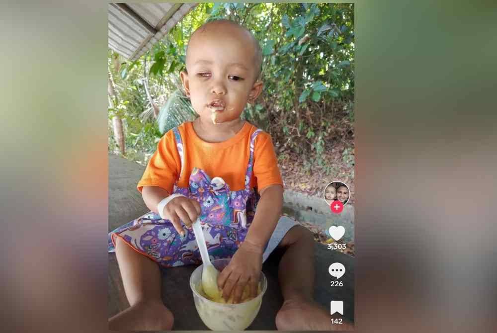 Alisa Umairah kini memakai mata palsu