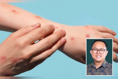 Kerajaan Pulau Pinang menafikan berlaku penularan penyakit mpox di negeri ini seperti yang ditularkan dalam media sosial baru-baru ini. (Gambar kecil: Daniel Gooi)
