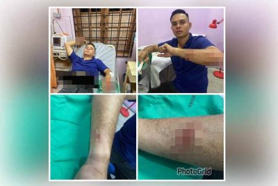 Seorang anggota polis cedera selepas diserang lelaki menggunakan gunting pokok di Kampung Kijang, Badang, Kota Bharu awal pagi Sabtu.