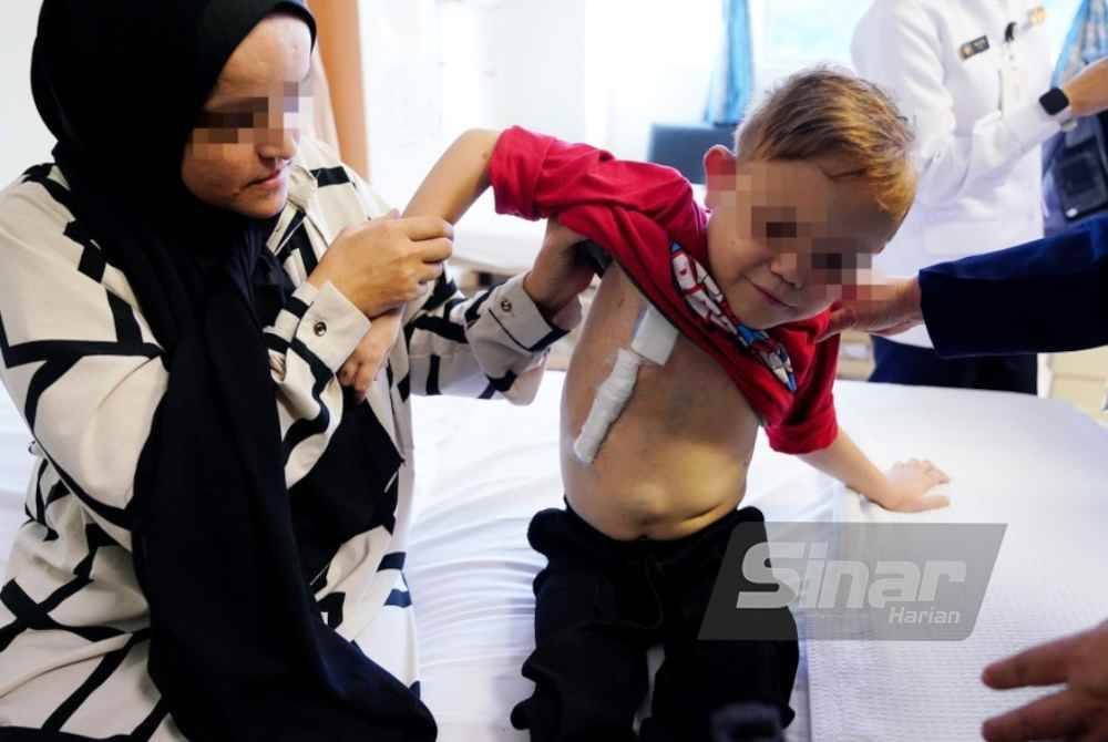 Kesan rawatan dialisis pada tubuh Zain Suhail. Foto Sinar Harian-MOHD HALIM ABDUL WAHID