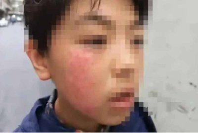 Pipi Liu menjadi pudar selepas ditampar guru. Agensi