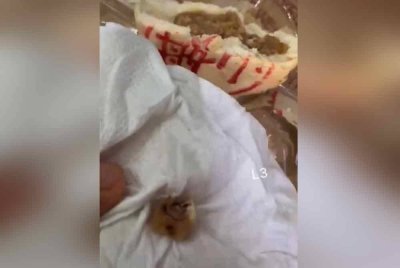 Gigi manusia yang didakwa 'terselit' di dalam inti kuih bulan tersebut. Foto Agensi