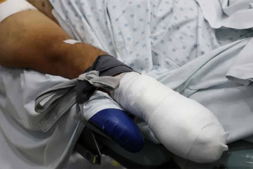 Kementerian Kesihatan Lubnan melaporkan kebanyakan mangsa letupan kehilangan jari atau kudung tangan.