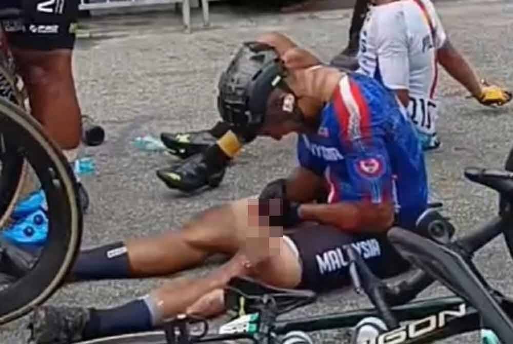 Jari tangan Mohd Elmi yang kelihatan berdarah selepas kemalangan. Foto: Media sosial