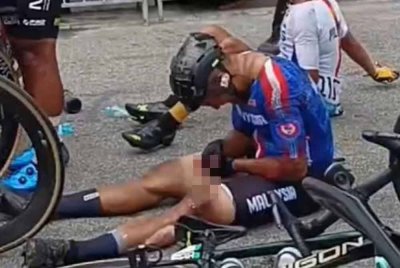 Jari tangan Mohd Elmi yang kelihatan berdarah selepas kemalangan. Foto: Media sosial