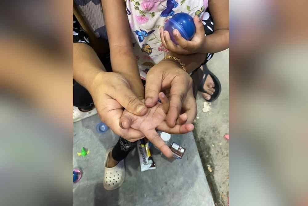 Mangsa hanya mengalami kecederaan ringan di tangan kanan akibat tersepit pada mesin permainan. Foto Ihsan JBPM Perak