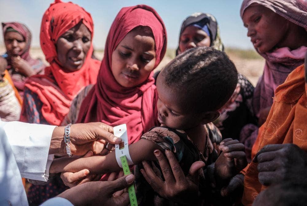 Petugas kesihatan memeriksa kesihatan seorang kanak-kanak di sebuah klinik bergerak yang diusahakan Save The Children di Antalale, Ethiopia. - AFP