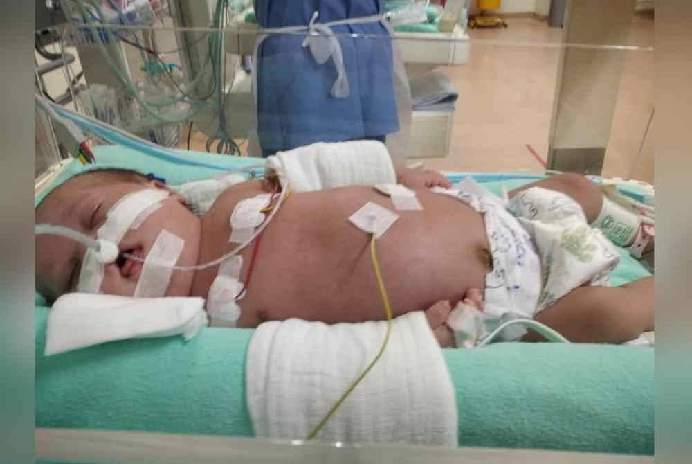 Nor Sara Washfa kini berada dalam keadaan kritikal dan dirawat di unit rawatan rapi neonatal (NICU) dengan bergantung alat bantuan oksigen.