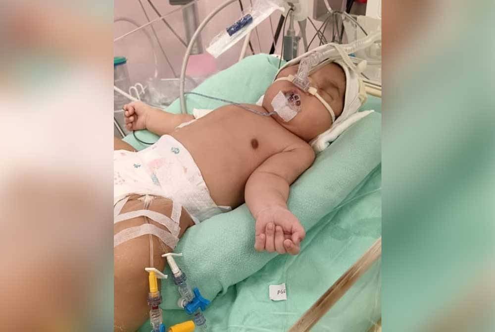 Bayi Siti Norhasirah yang berusia 28 hari di Unit Rawatan Rapi Neonatal (NICU), Hospital Sultan Ismail Petra, Kuala Krai selepas mengalami masalah saluran oksigen tertukar.