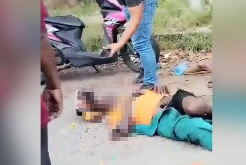 Mangsa yang mengalami cedera parah di bahagian mata kini sedang menjalani pembedahan di Hospital Pulau Pinang.