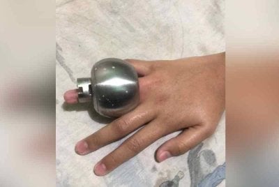 Seorang kanak-kanak perempuan terpaksa menahan kesakitan selama lebih satu jam selepas jari manisnya tersekat pada tombol pintu.