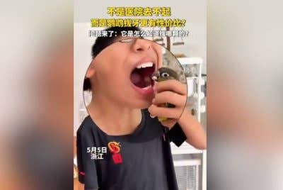 Gelagat seekor burung kakak tua mencabut gigi budak lelaki di Foshan, China. Agensi