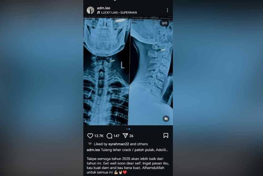 Tangkap layar daripada hantaran di Instagram pada Khamis.