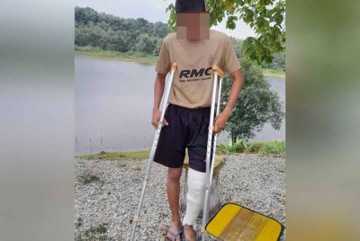 Gambar terkini keadaan kaki mangsa buli yang masih berbalut selepas diarah melakukan 'hell' melampau.