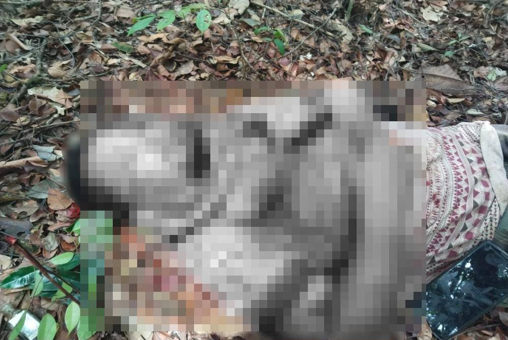 Keadaan Nik Azhar selepas diserang beruang dalam kejadian di sebuah ladang sawit dekat Kampung Telembuh, Jerangau Sungai, Dungun, pada Khamis. Foto Ihsan keluarga