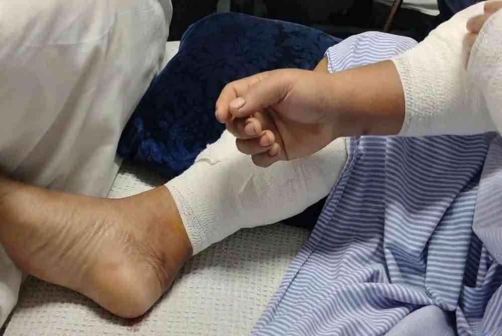 Terdapat beberapa kecederaan lain pada betis, lengan dan tangan akibat digigit beruang.