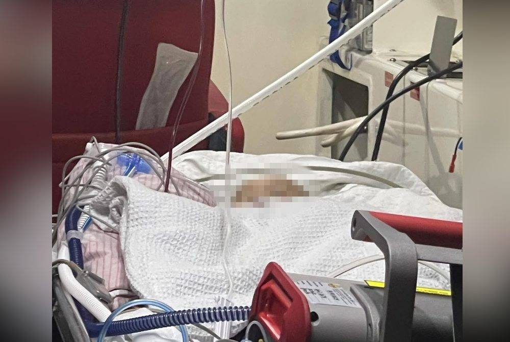 Nur Irdina Delisha dirawat di PICU, HRPZ II.