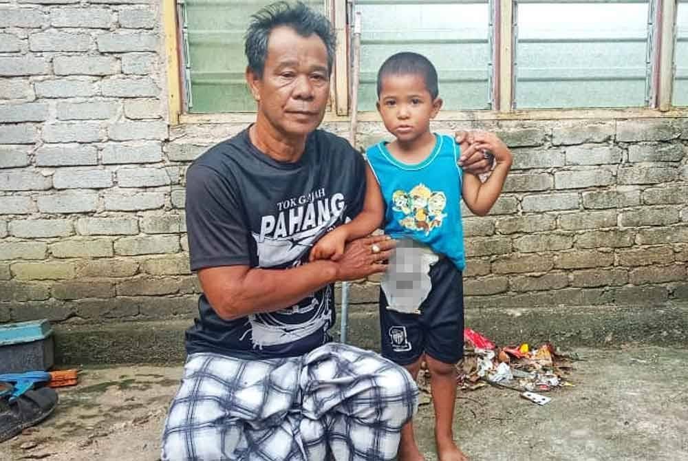 Mat No menunjukkan beg stoma yang perlu dipakai oleh Mohd Adam. Foto ihsan orang awam