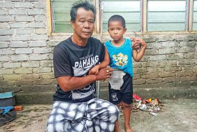 Mat No menunjukkan beg stoma yang perlu dipakai oleh Mohd Adam. Foto ihsan orang awam