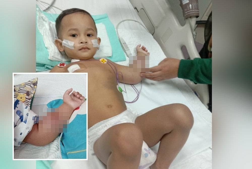 Muhammad Adib Saqeef semasa mendapatkan rawatan untuk kanser ototnya di lengan tangan sebelah kiri.(Gambar kecil: Keadaan lengan tangan Adib Saqeef yang membengkak sebelum disahkan menghidap kanser otot.)