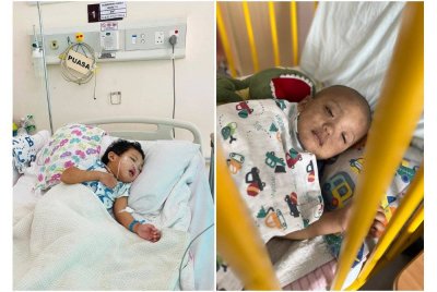 Muhammad Hariz Iman ketika mendapatkan rawatan di hospital. (Kanan: Keadaan kulit Muhammad Hariz Iman selepas menjalani rawatan kemoterapi. Foto: Mohd Herman dan Norshahida)