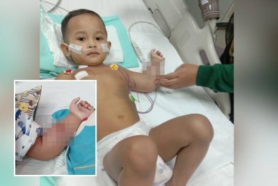 Muhammad Adib Saqeef semasa mendapatkan rawatan untuk kanser ototnya di lengan tangan sebelah kiri.(Gambar kecil: Keadaan lengan tangan Adib Saqeef yang membengkak sebelum disahkan menghidap kanser otot.)