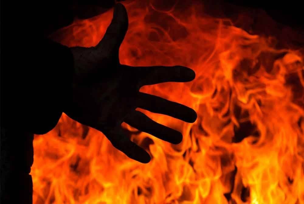 Seorang remaja lelaki berusia 14 tahun bertindak kejam membakar bapa kandungnya selepas dimarahi kerana disyaki mencuri wang. Foto 123RF