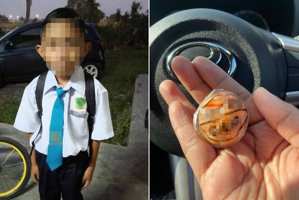Mangsa kini dilaporkan kritikal di PICU HPP. (Gambar kanan: Gula-gula kenyal yang ditemui di dalam baju sekolah mangsa).