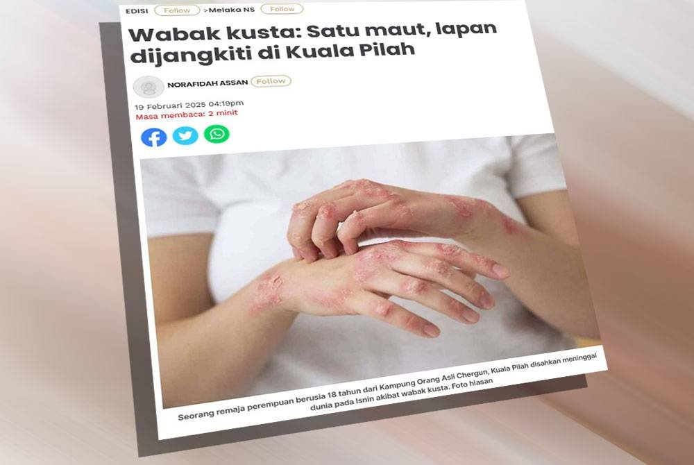 Laporan Sinar Harian mengenai wabak kusta yang melanda di Kuala Pilah.